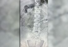 Ataparon a dos mulas que habían ingerido más 185 cápsulas de cocaína en un tour de compras que se dirigía a Buenos Aires