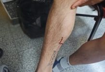 Delincuentes le robaron la moto a un hombre en La Plata y le dispararon antes de huir