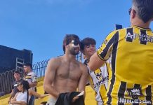 Santiago Sosa mostró cómo quedó su rostro tras la operación por la fractura que sufrió por un golpe de Marcos Rojo