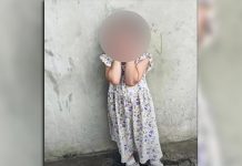 Una nena de 2 años fue atropellada por un patrullero en Manuel Alberti: está delicada y piden cadena de oración